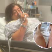Ill - Carla was taken to hospital following the snake bite, which left her with 